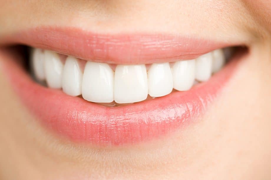 What Should I Eat After Teeth Whitening?